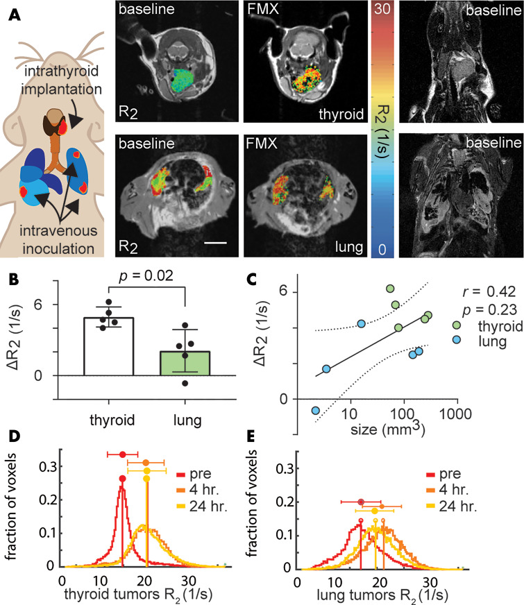 Ferumoxytol (FMX)-enhanced MRI shows lower uptake in pulmonary compared with thyroid lesions from anaplastic thyroid cancer (ATC). A, Representative T2-weighted images, with overlaid R2 maps of an ATC tumor and multiple lung lesions in separate B6129SF1/J mice before and 24 hours after intravenous injection of ferumoxytol by using the TBP-3743 model (scale bar, 5 mm). Tumor voxels that did not appropriately fit to the monoexponential curve, as previously defined (22), were excluded from analysis (black voxels). Corresponding baseline coronal images are shown at right. B, Ferumoxytol-induced change in R2 (ΔR2) was quantified over the segmented tumor volumes. C, Tumor size and change in R2 did not correlate (data are means across tumors for individual mice; log-linear regression and 95% CI shown in gray). R2 voxel histogram distributions pooled across, D, thyroid and, E, lung tumors, before and after administration with ferumoxytol. For all, data points and error bars are means ± standard deviation.