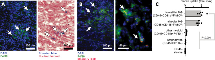 Immunologic assessment of ferumoxytol and macrin cellular uptake. Lungs bearing anaplastic thyroid cancer (ATC) tumors, by using the TBP-3743 model, were excised 24 hours after administration with ferumoxytol and macrin. Within tumors, arrows mark colocalization in cellular staining of, A, iron oxide (by using Prussian blue) and F4/80, and, B, macrin and F4/80. C, Uptake of macrin on a per-cell basis was quantified by flow cytometry, after immunologic definition of cell populations from tumor-bearing lung tissue (Fig E2 [online] shows gating scheme). DAPI = 4’,6-diamidino-2-phenylindole, frac. max = fraction maximum, MΦ = macrophages.