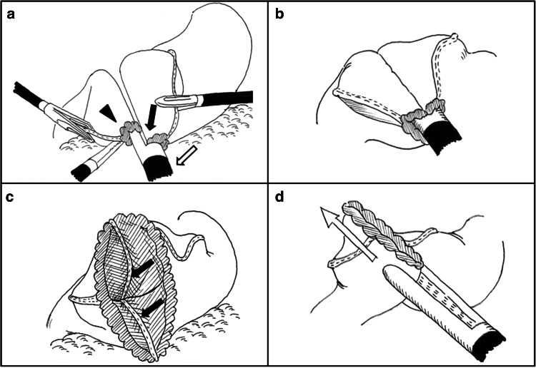 Fig. 2