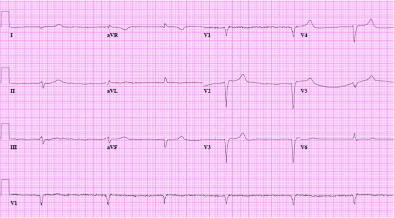 Fig. 1