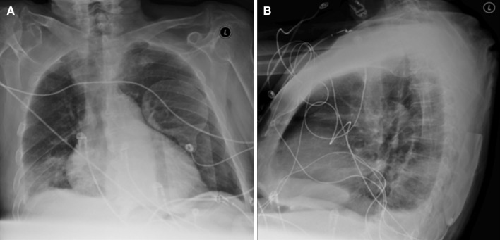 Fig. 2