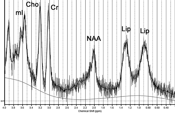 Fig 3.