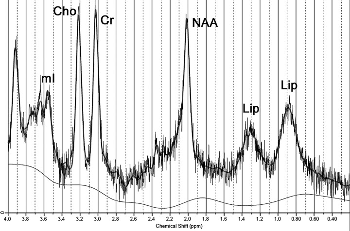 Fig 4.