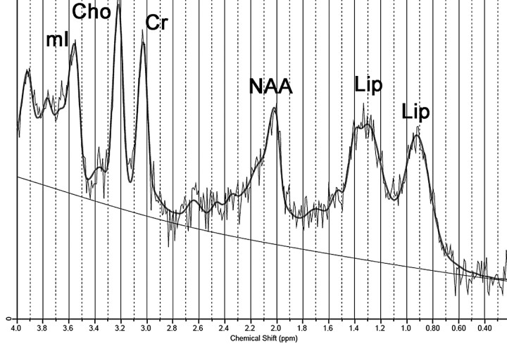 Fig 2.