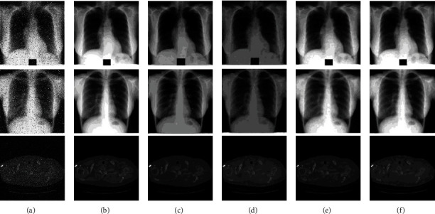 Figure 11