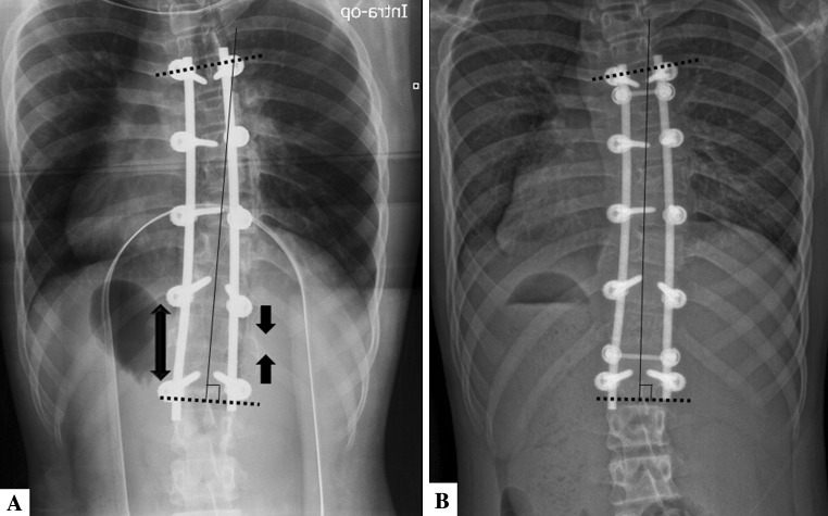 Fig. 3A–B