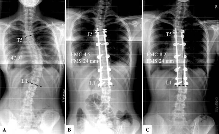 Fig. 7A–C