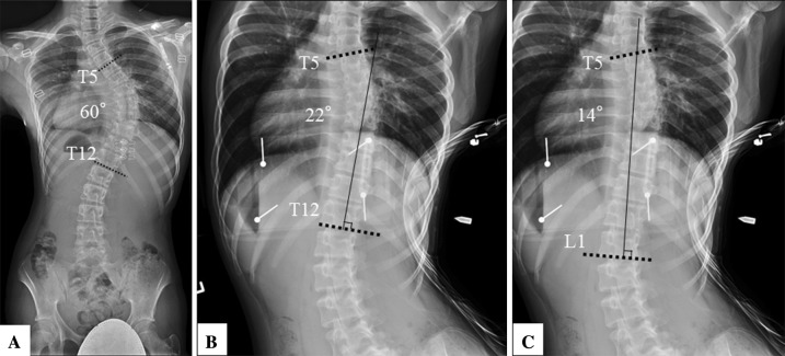 Fig. 2A–C