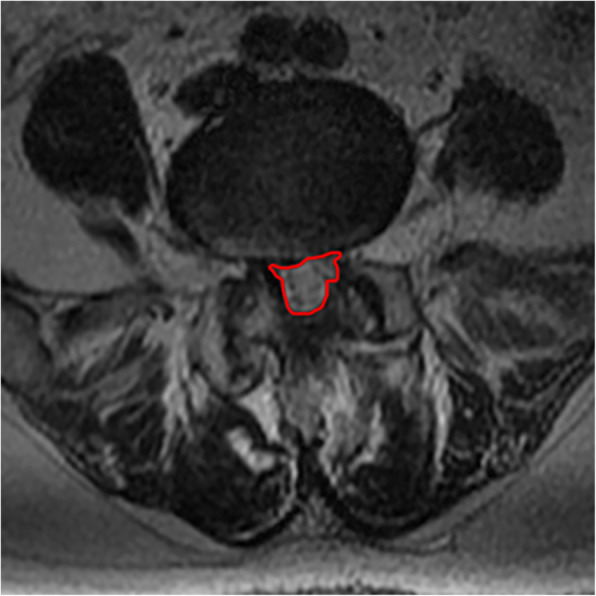 Fig. 10