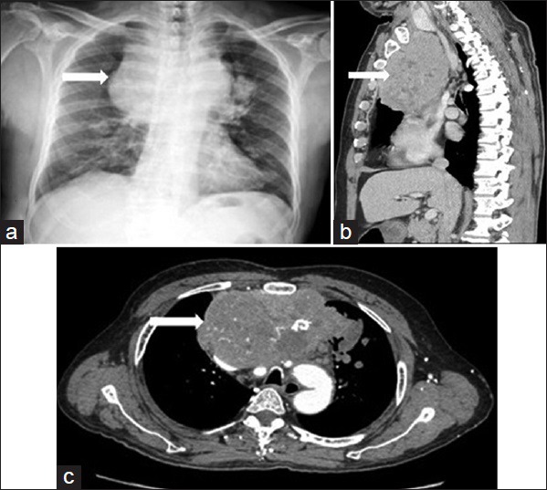 Figure 21