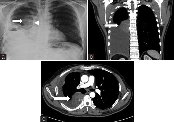 Figure 22