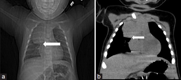 Figure 24