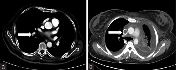 Figure 19