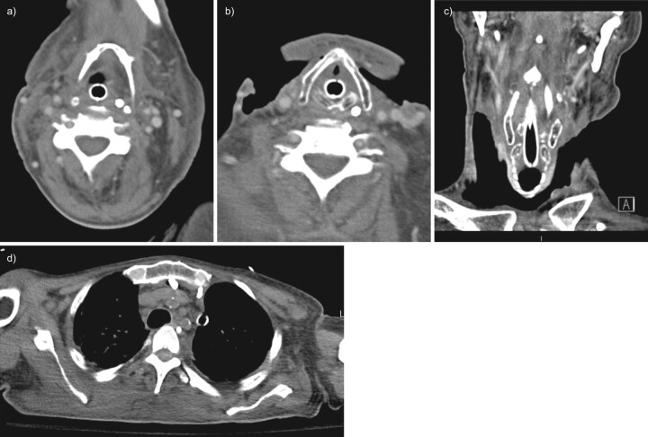 FIGURE 3. 