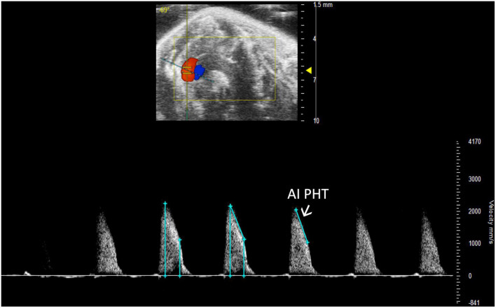 FIGURE 13