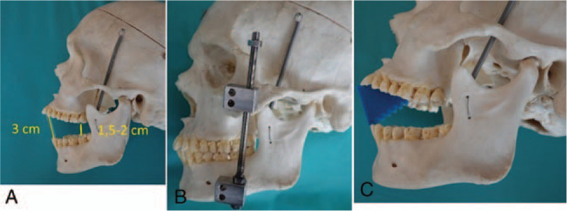 FIGURE 1