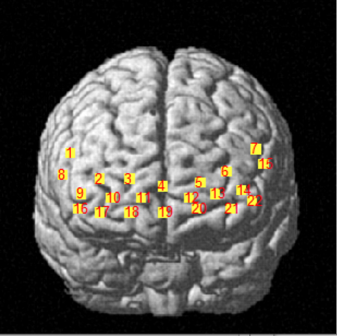 Fig. 2