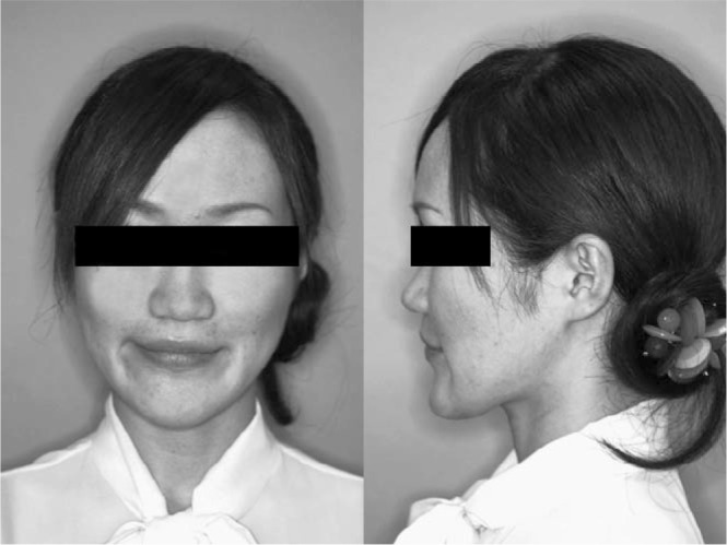 Figure 5. Posttreatment facial photographs.