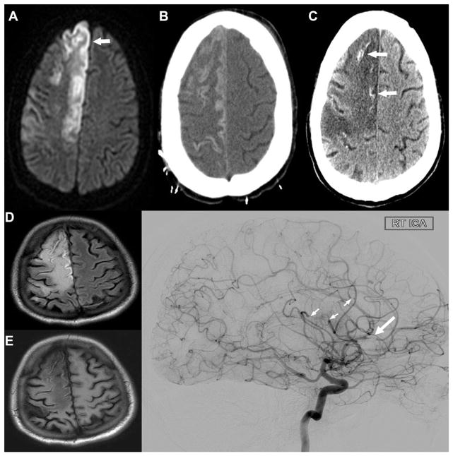Fig. 3