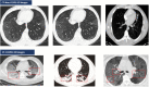 Fig. 6