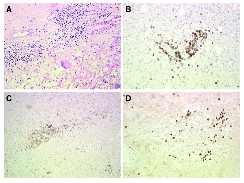 Fig 4.