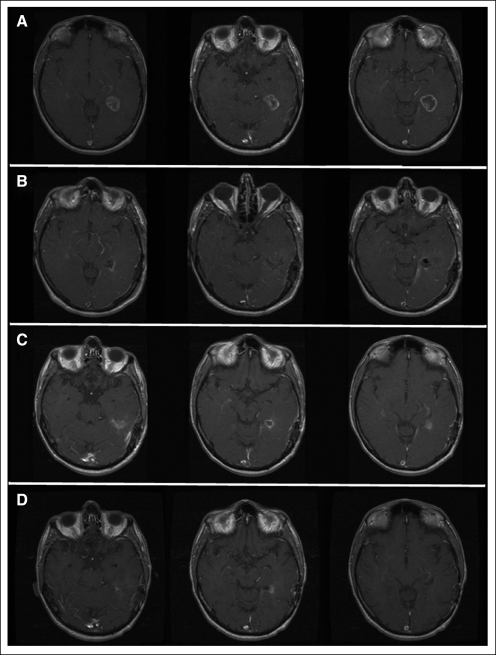 Fig 3.