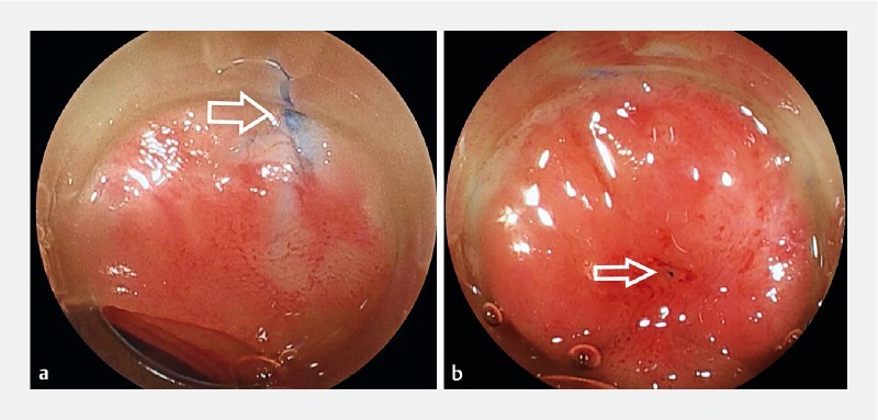 Fig. 3