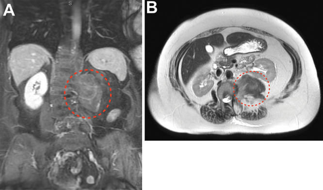 FIG. 2.