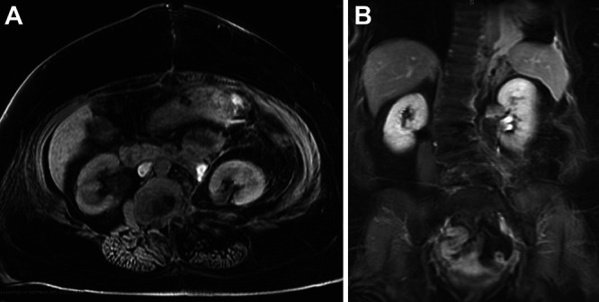 FIG. 4.