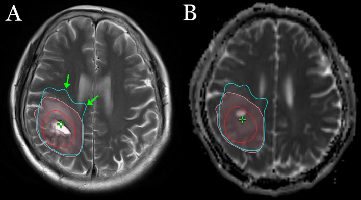 Figure 2