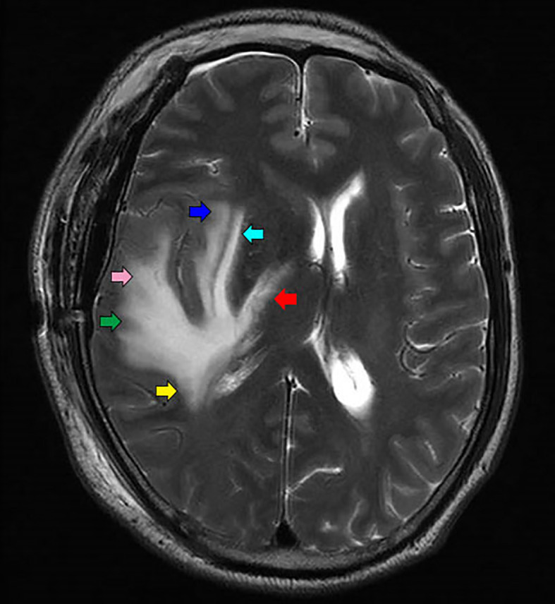 Figure 5