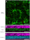 Fig. 12.