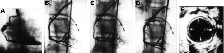 Figure 1  