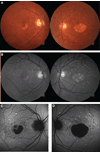 Fig. 4