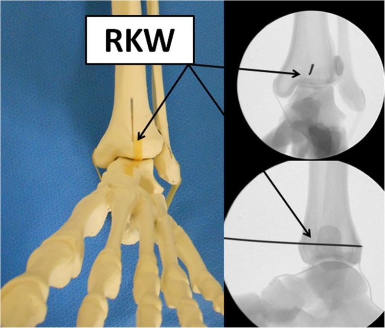 Fig. 2