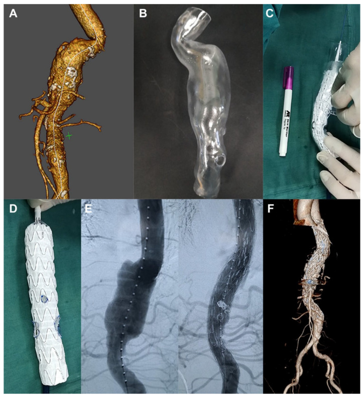 Figure 14