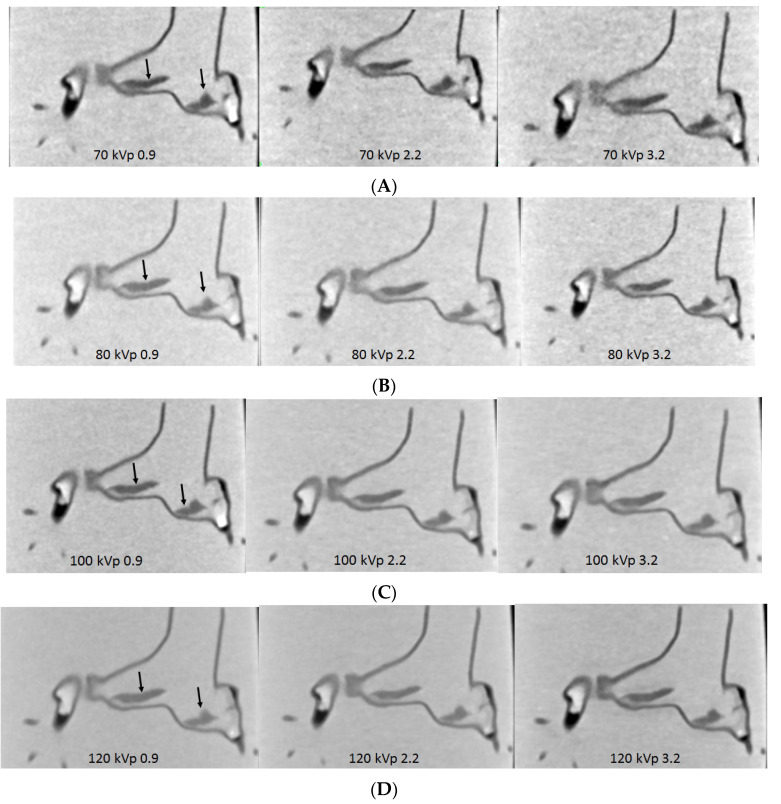 Figure 16