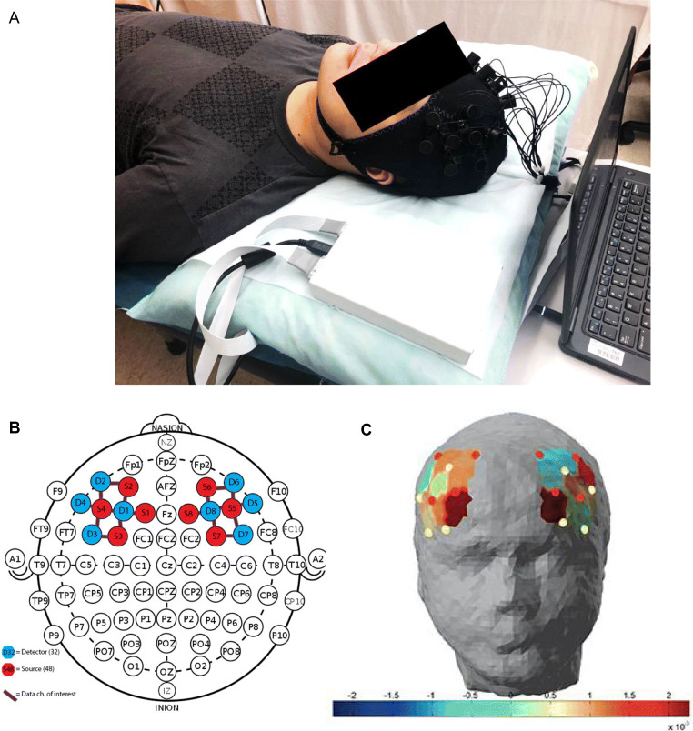 Fig. 1