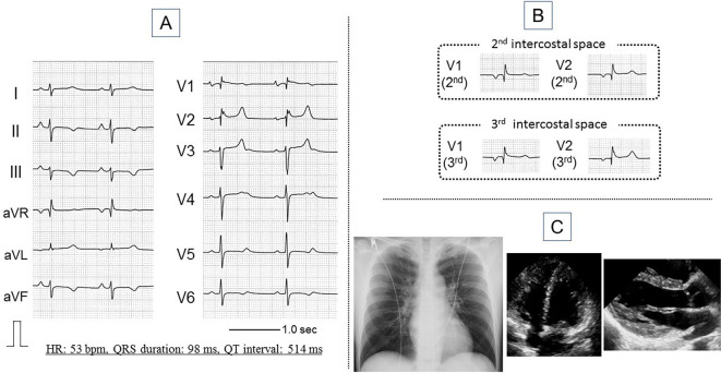 Figure 1.