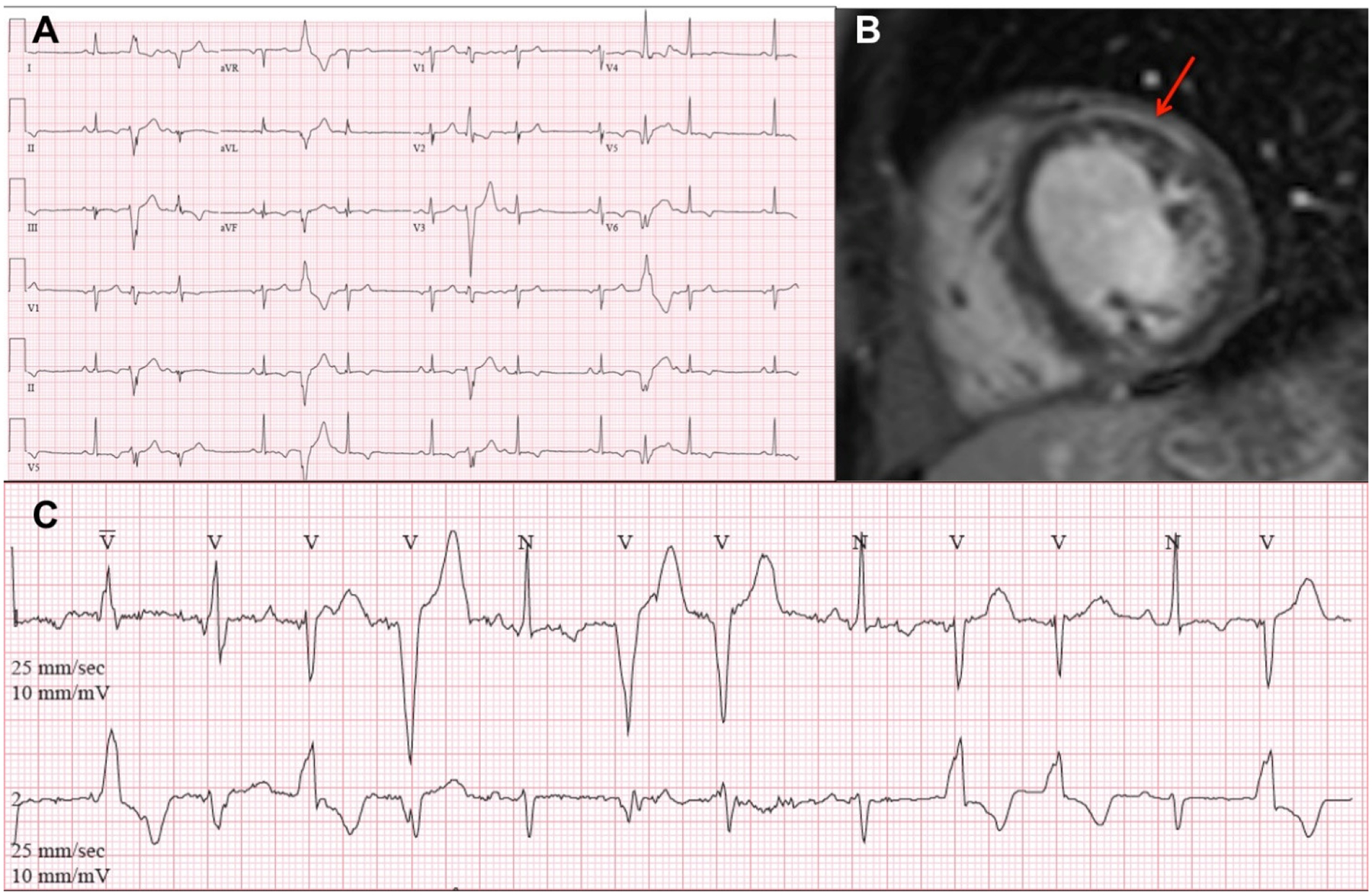 Figure 2.