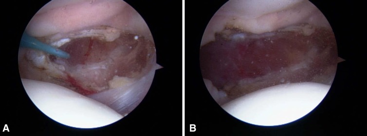 Fig. 4A–B