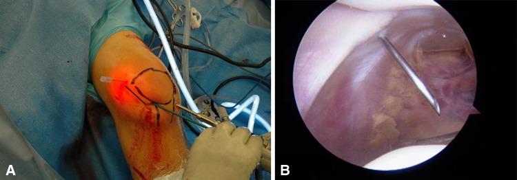 Fig. 2A–B