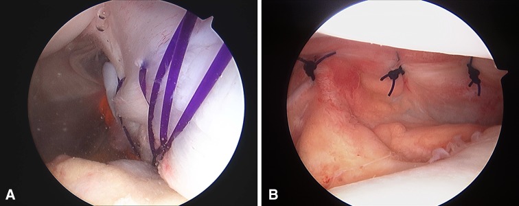 Fig. 1A–B