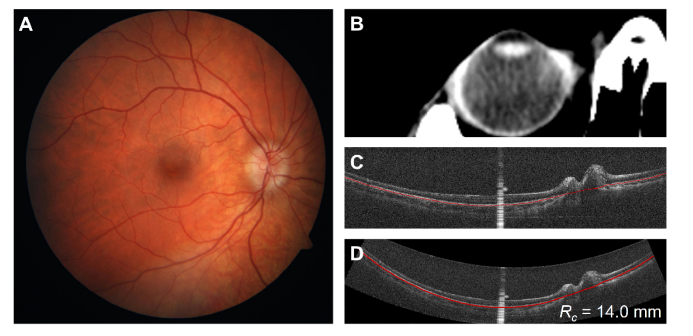 Fig. 13