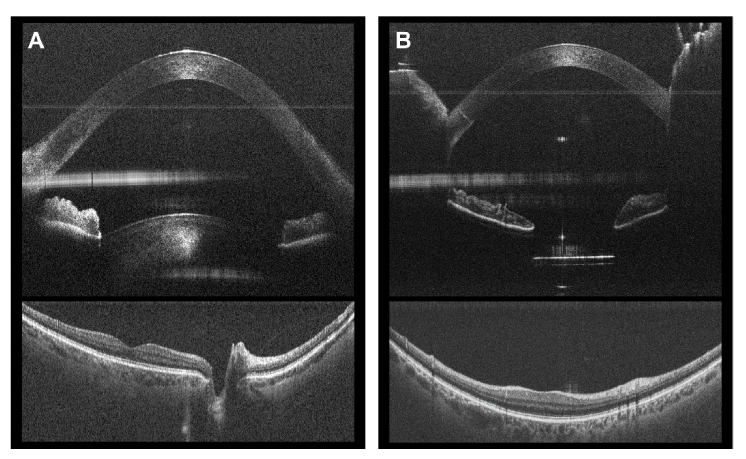 Fig. 10