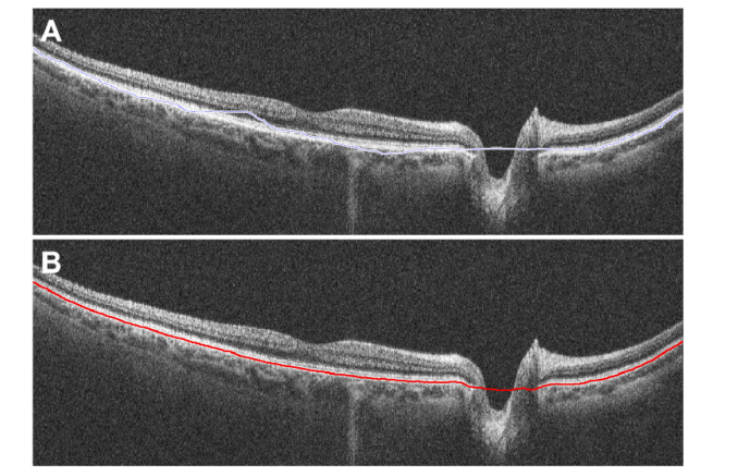 Fig. 4