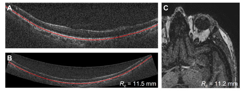 Fig. 11