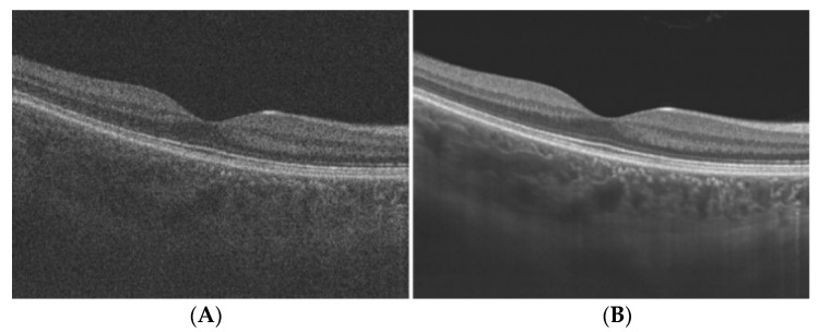 Figure 12