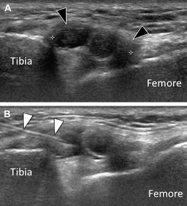 Fig. 6