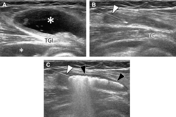 Fig. 5